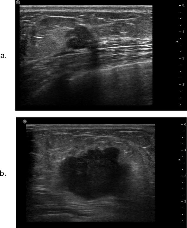 https://cdn.ncbi.nlm.nih.gov/pmc/blobs/4cab/4348341/c0249b46c65b/pone.0114820.g001.jpg