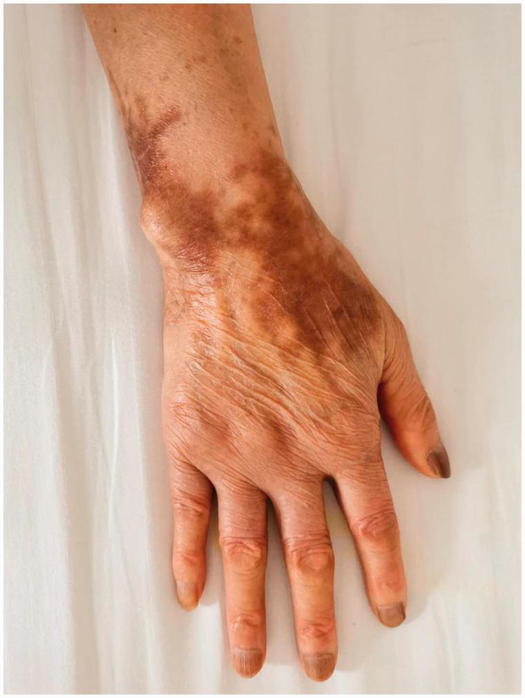 https://cdn.ncbi.nlm.nih.gov/pmc/blobs/4cae/7770262/d120944729c1/10.1177_0300060520974854-fig3.jpg