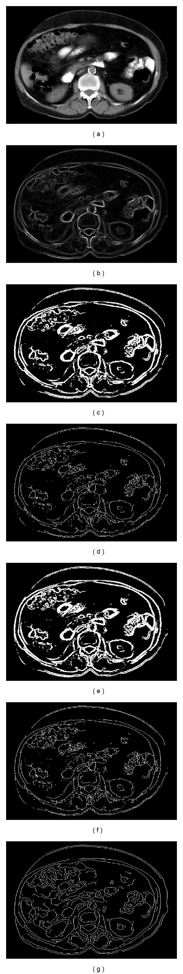 https://cdn.ncbi.nlm.nih.gov/pmc/blobs/4cb0/3982282/e0cba36eaf8b/TSWJ2014-964870.007.jpg