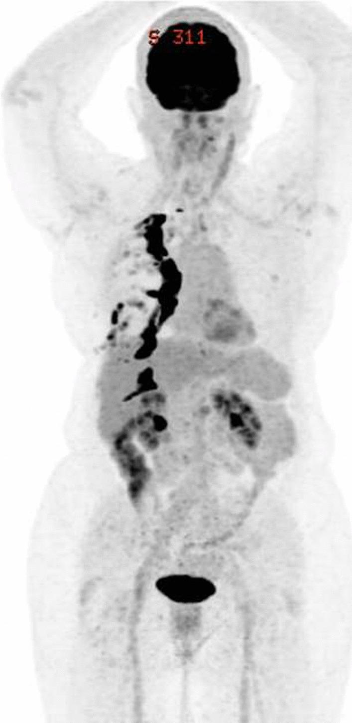 https://cdn.ncbi.nlm.nih.gov/pmc/blobs/4cbc/9635214/ba575f6e7ebe/13256_2022_3593_Fig4_HTML.jpg