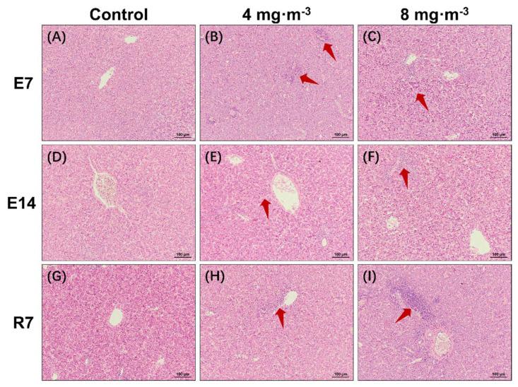 https://cdn.ncbi.nlm.nih.gov/pmc/blobs/4cbe/10052321/11c9b0149d5f/metabolites-13-00363-g002.jpg