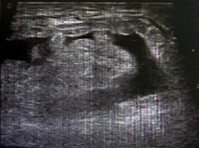 https://cdn.ncbi.nlm.nih.gov/pmc/blobs/4cbf/8717499/a8983bb16d6f/WJCC-9-11355-g001.jpg