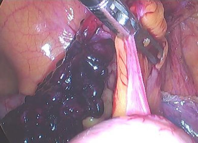 https://cdn.ncbi.nlm.nih.gov/pmc/blobs/4cbf/8717499/ea81f161b43c/WJCC-9-11355-g004.jpg