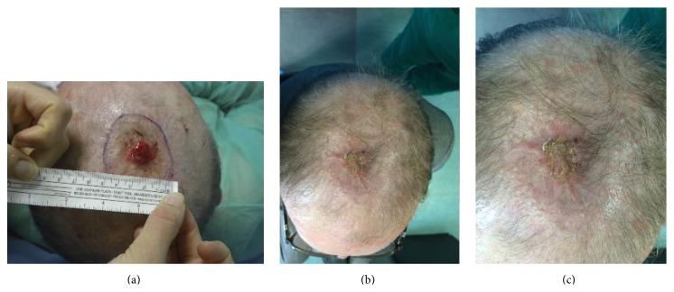 https://cdn.ncbi.nlm.nih.gov/pmc/blobs/4cc0/4663323/167a82b40d1d/BMRI2015-698385.008.jpg