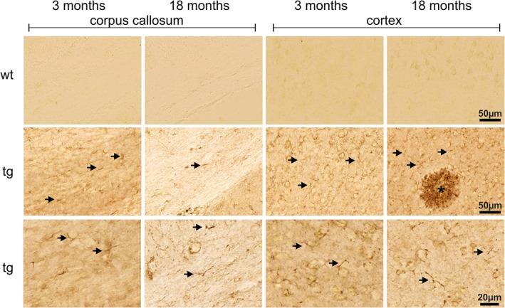 https://cdn.ncbi.nlm.nih.gov/pmc/blobs/4cc2/6588085/571a6f8b2e20/GLIA-67-393-g001.jpg