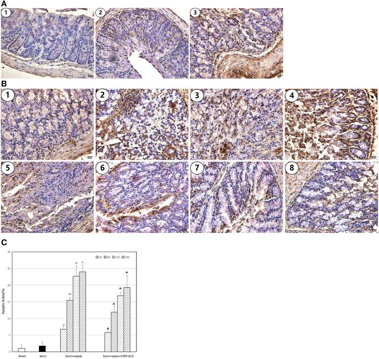 https://cdn.ncbi.nlm.nih.gov/pmc/blobs/4cde/8907476/37075ae2d938/fmed-09-809289-g0003.jpg