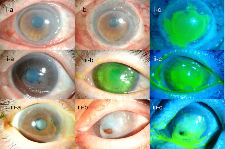 https://cdn.ncbi.nlm.nih.gov/pmc/blobs/4ce2/7136173/feb67c30e0fb/gr1.jpg
