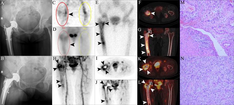 https://cdn.ncbi.nlm.nih.gov/pmc/blobs/4ce4/9233412/38e0042354d0/BJR-11-398-g0002.jpg