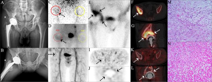https://cdn.ncbi.nlm.nih.gov/pmc/blobs/4ce4/9233412/ed3156fb9bc5/BJR-11-398-g0004.jpg
