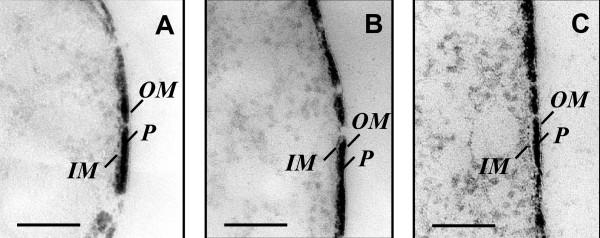 https://cdn.ncbi.nlm.nih.gov/pmc/blobs/4ce6/1829397/80c70592477f/1471-2180-7-16-5.jpg