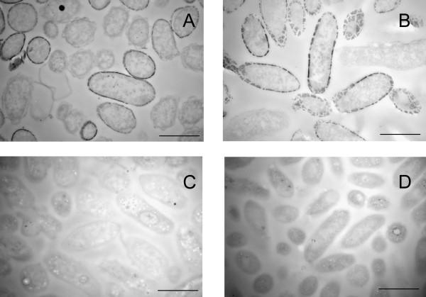https://cdn.ncbi.nlm.nih.gov/pmc/blobs/4ce6/1829397/82bdab1bc662/1471-2180-7-16-3.jpg