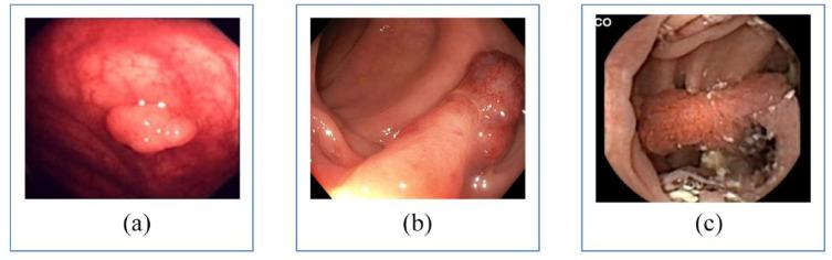 https://cdn.ncbi.nlm.nih.gov/pmc/blobs/4ce7/9685101/e3b7f42e61fb/10.1177_20406223221137501-fig1.jpg
