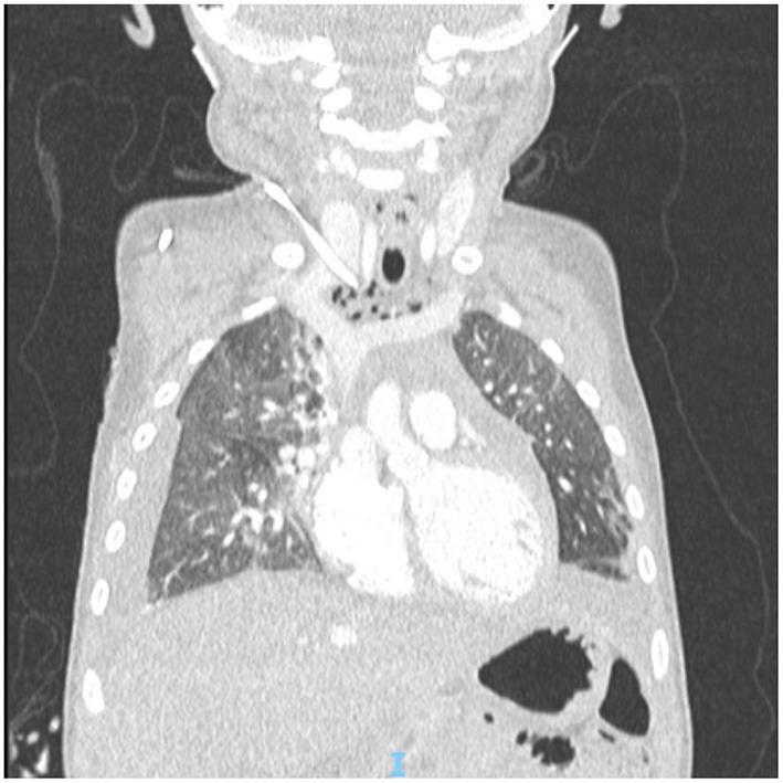 https://cdn.ncbi.nlm.nih.gov/pmc/blobs/4ced/9386129/6416cc398432/fped-10-947351-g0003.jpg