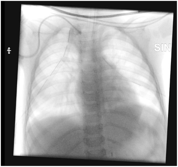 https://cdn.ncbi.nlm.nih.gov/pmc/blobs/4ced/9386129/f73cc1ce4447/fped-10-947351-g0004.jpg