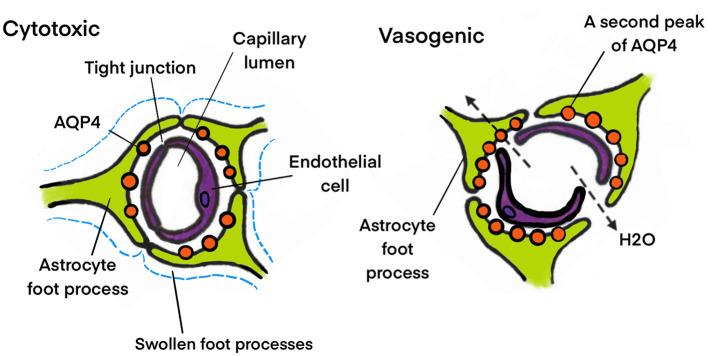 https://cdn.ncbi.nlm.nih.gov/pmc/blobs/4cfe/11814447/a6a60dd08460/fnins-19-1518967-g0005.jpg