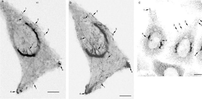 https://cdn.ncbi.nlm.nih.gov/pmc/blobs/4d02/2156170/fe6fe981f813/JCB9907113.f2.jpg