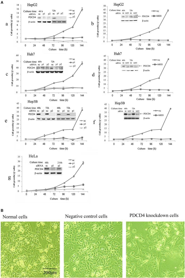 https://cdn.ncbi.nlm.nih.gov/pmc/blobs/4d06/6334536/990a73bd211c/fonc-08-00661-g0001.jpg