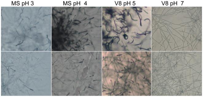 https://cdn.ncbi.nlm.nih.gov/pmc/blobs/4d0b/2835752/753bd4da86e8/pone.0009620.g003.jpg