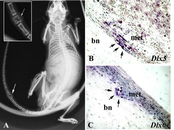 https://cdn.ncbi.nlm.nih.gov/pmc/blobs/4d0b/3003273/4a3ddfe540a9/1471-2407-10-649-2.jpg