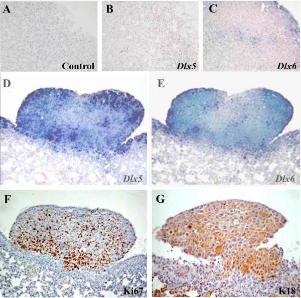 https://cdn.ncbi.nlm.nih.gov/pmc/blobs/4d0b/3003273/4ff5358d43b5/1471-2407-10-649-3.jpg