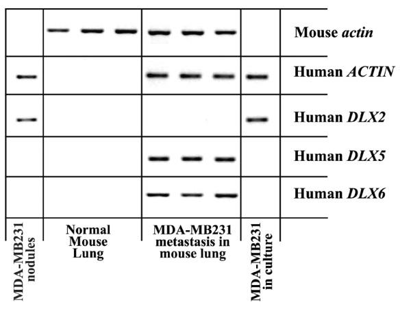 https://cdn.ncbi.nlm.nih.gov/pmc/blobs/4d0b/3003273/67de741bd2c5/1471-2407-10-649-1.jpg