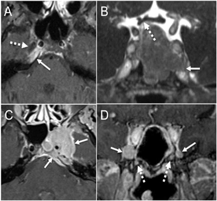 https://cdn.ncbi.nlm.nih.gov/pmc/blobs/4d0c/5750829/458203ac4030/jiufd-051-s062-e005.jpg