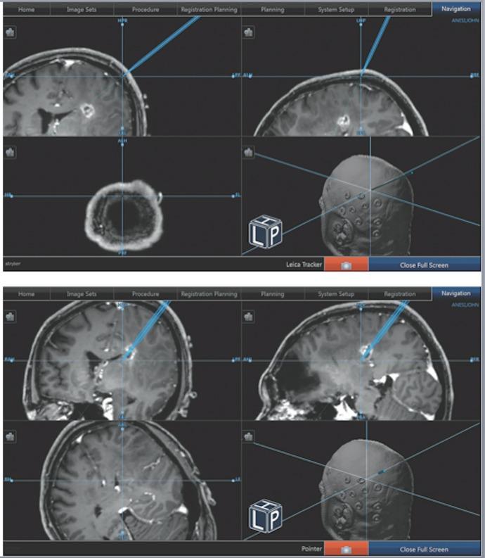 https://cdn.ncbi.nlm.nih.gov/pmc/blobs/4d10/5338990/6b2176d494f6/cureus-0009-00000001012-i01.jpg