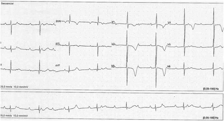 https://cdn.ncbi.nlm.nih.gov/pmc/blobs/4d14/12006191/48d11ee1ae37/fcvm-12-1552423-g002.jpg