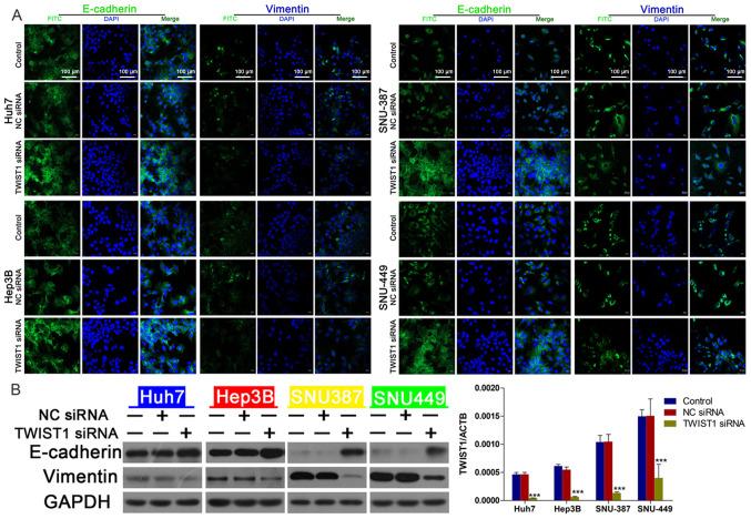https://cdn.ncbi.nlm.nih.gov/pmc/blobs/4d16/7974311/2b9bf9d93a31/mmr-23-05-11979-g04.jpg