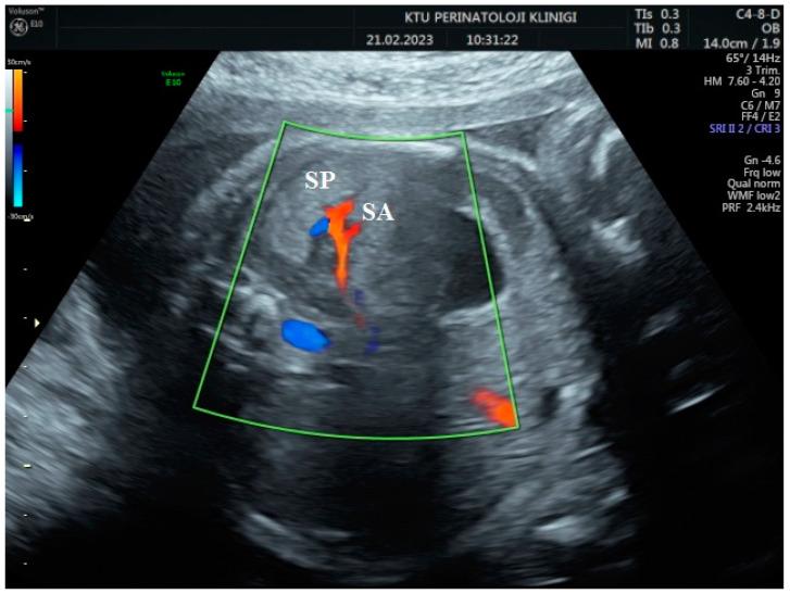 https://cdn.ncbi.nlm.nih.gov/pmc/blobs/4d1e/11121822/1a77e4969dd1/jpm-14-00480-g001.jpg