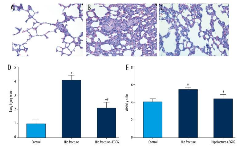 https://cdn.ncbi.nlm.nih.gov/pmc/blobs/4d1f/5519220/e04764423bf9/medscimonit-23-3367-g002.jpg