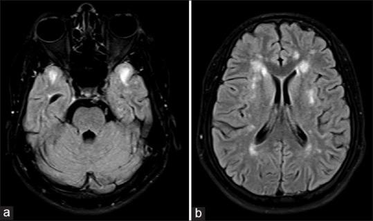 https://cdn.ncbi.nlm.nih.gov/pmc/blobs/4d20/4692034/ad66614759c6/JNRP-6-622-g001.jpg