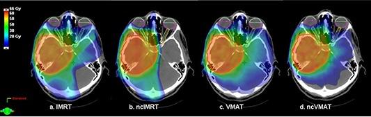 https://cdn.ncbi.nlm.nih.gov/pmc/blobs/4d22/5716518/192d033d8c7d/ACM2-13-044-g002.jpg