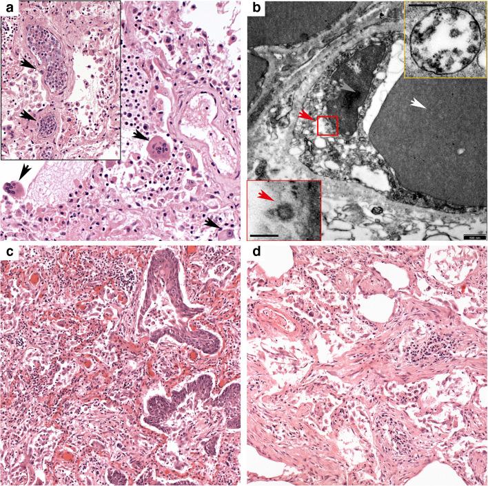 https://cdn.ncbi.nlm.nih.gov/pmc/blobs/4d24/7443182/7ebb80fdedc0/428_2020_2881_Fig4_HTML.jpg