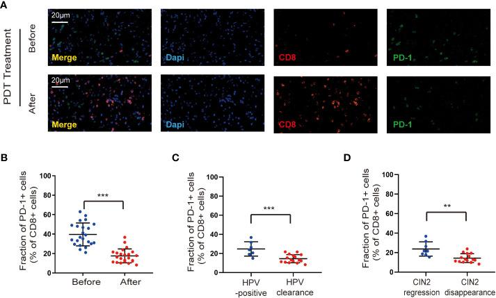 https://cdn.ncbi.nlm.nih.gov/pmc/blobs/4d27/10623119/3da6f55e2872/fimmu-14-1211114-g004.jpg