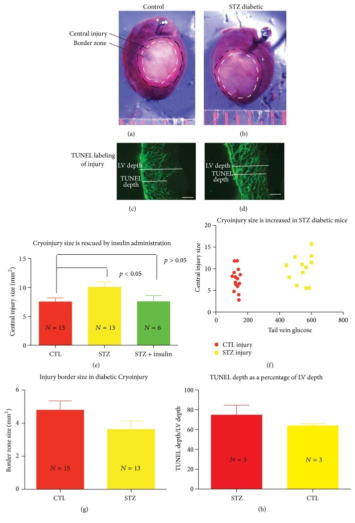 https://cdn.ncbi.nlm.nih.gov/pmc/blobs/4d28/4804645/3c519e5cb4ca/JDR2016-8789617.001.jpg