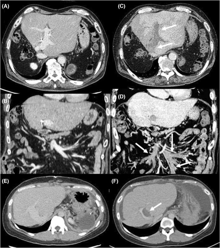 https://cdn.ncbi.nlm.nih.gov/pmc/blobs/4d2a/10472375/3660e4297f36/AGS3-7-800-g005.jpg