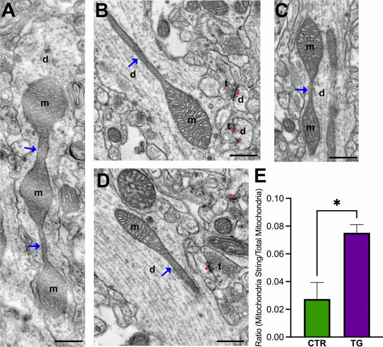 https://cdn.ncbi.nlm.nih.gov/pmc/blobs/4d2a/12078374/11848002d3e3/12035_2024_4632_Fig4_HTML.jpg