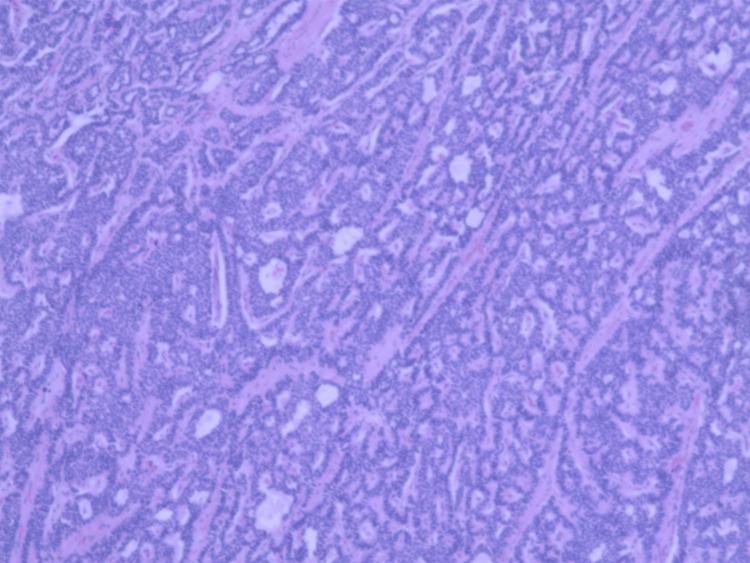 https://cdn.ncbi.nlm.nih.gov/pmc/blobs/4d38/11372752/2ef2743c1439/cureus-0016-00000066004-i06.jpg