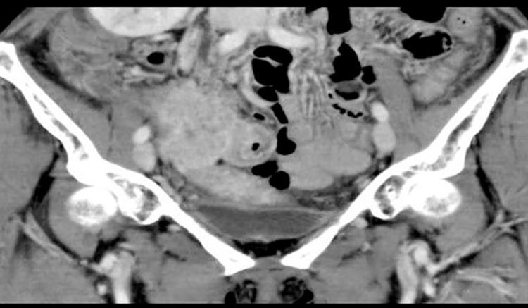 https://cdn.ncbi.nlm.nih.gov/pmc/blobs/4d38/6000908/f6f6c46762b5/gr1.jpg