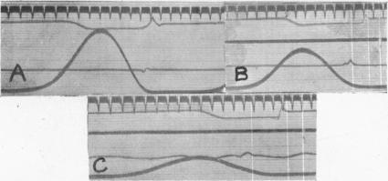 https://cdn.ncbi.nlm.nih.gov/pmc/blobs/4d3e/1514773/f21bce45e48b/jphysiol02523-0030-a.jpg