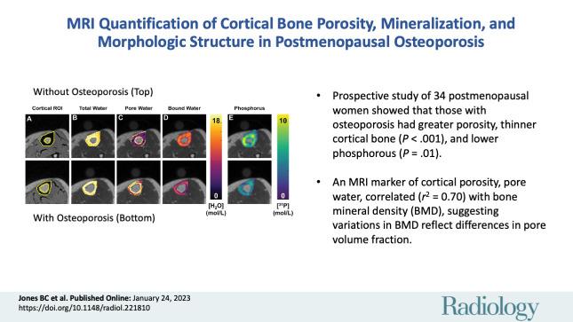 https://cdn.ncbi.nlm.nih.gov/pmc/blobs/4d3f/10102628/fc25472450b3/radiol.221810.VA.jpg