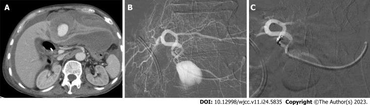 https://cdn.ncbi.nlm.nih.gov/pmc/blobs/4d41/10505992/82dd8e4d85f3/WJCC-11-5835-g002.jpg