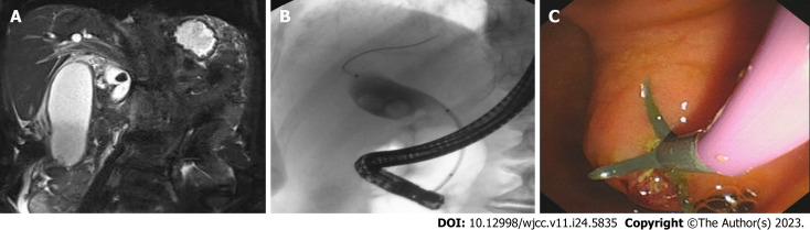 https://cdn.ncbi.nlm.nih.gov/pmc/blobs/4d41/10505992/b2ff05d0d4b7/WJCC-11-5835-g001.jpg