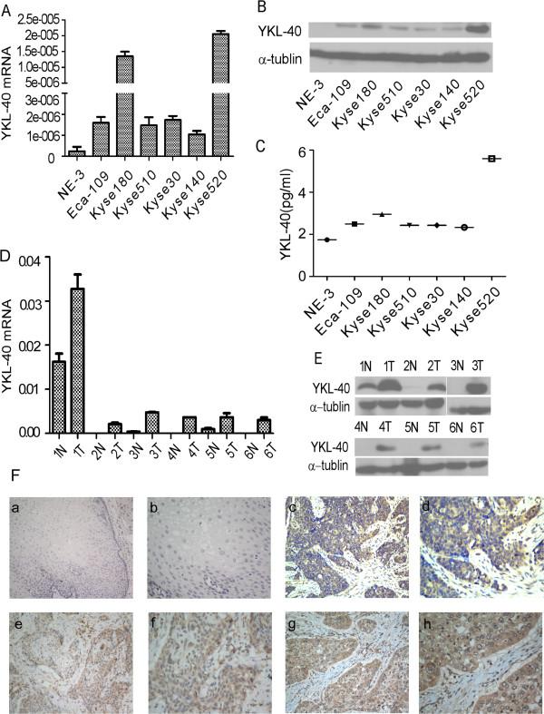 https://cdn.ncbi.nlm.nih.gov/pmc/blobs/4d50/4094903/2cc184479754/1471-2407-14-490-1.jpg