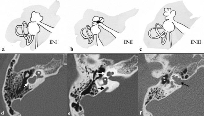 https://cdn.ncbi.nlm.nih.gov/pmc/blobs/4d53/8520521/956153521134/11547_2021_1387_Fig9_HTML.jpg