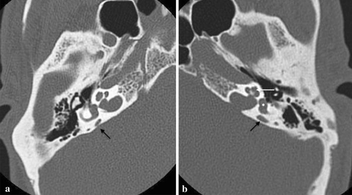 https://cdn.ncbi.nlm.nih.gov/pmc/blobs/4d53/8520521/a502cf145df1/11547_2021_1387_Fig11_HTML.jpg