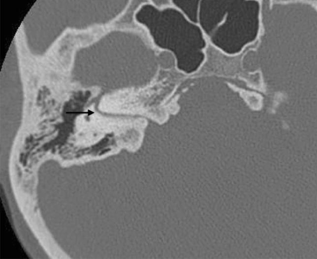 https://cdn.ncbi.nlm.nih.gov/pmc/blobs/4d53/8520521/b386d360236a/11547_2021_1387_Fig16_HTML.jpg