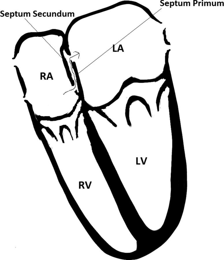 https://cdn.ncbi.nlm.nih.gov/pmc/blobs/4d56/3738369/8907b15ee9bb/10.1258_cvd.2012.012017-fig1.jpg