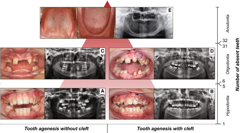 https://cdn.ncbi.nlm.nih.gov/pmc/blobs/4d57/5065589/8f26d6207aa8/439_2016_1733_Fig1_HTML.jpg